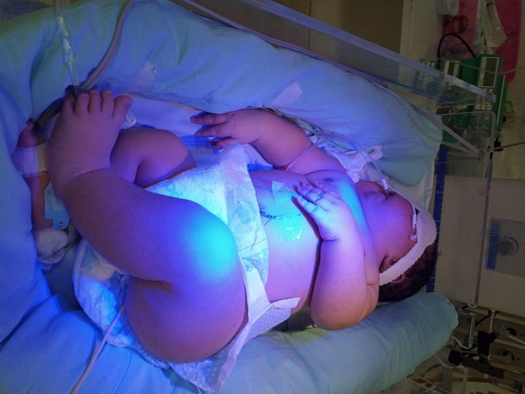 Bebê que nasceu com mais de 7kg