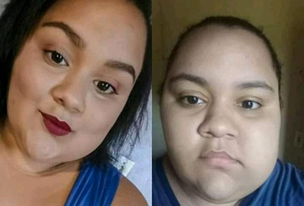 Maria Rita antes e depois do crescimento do cisto