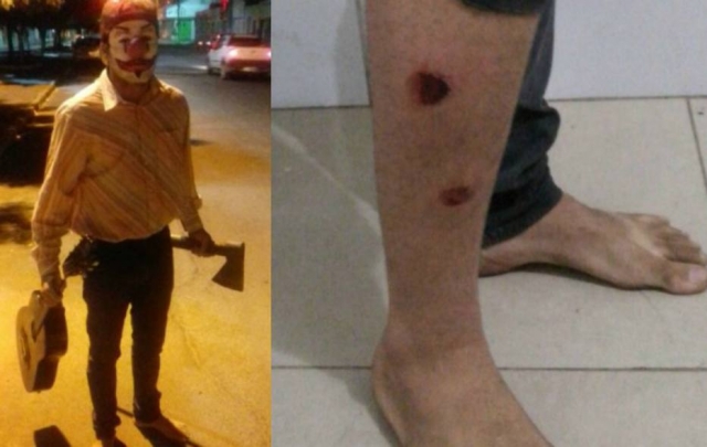 Jovem foi baleado na perna