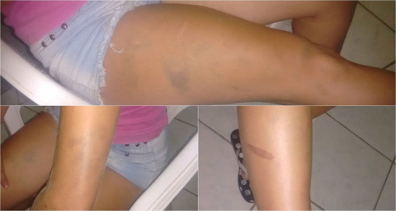 A jovem foi encontrada lesionada
