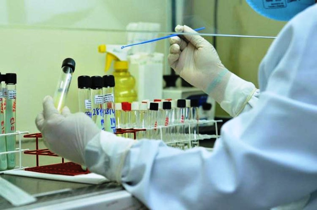 Teste para vírus da zika