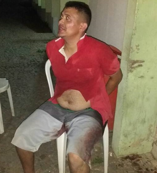 Homem tenta roubar arma de vigilante e é alvejado