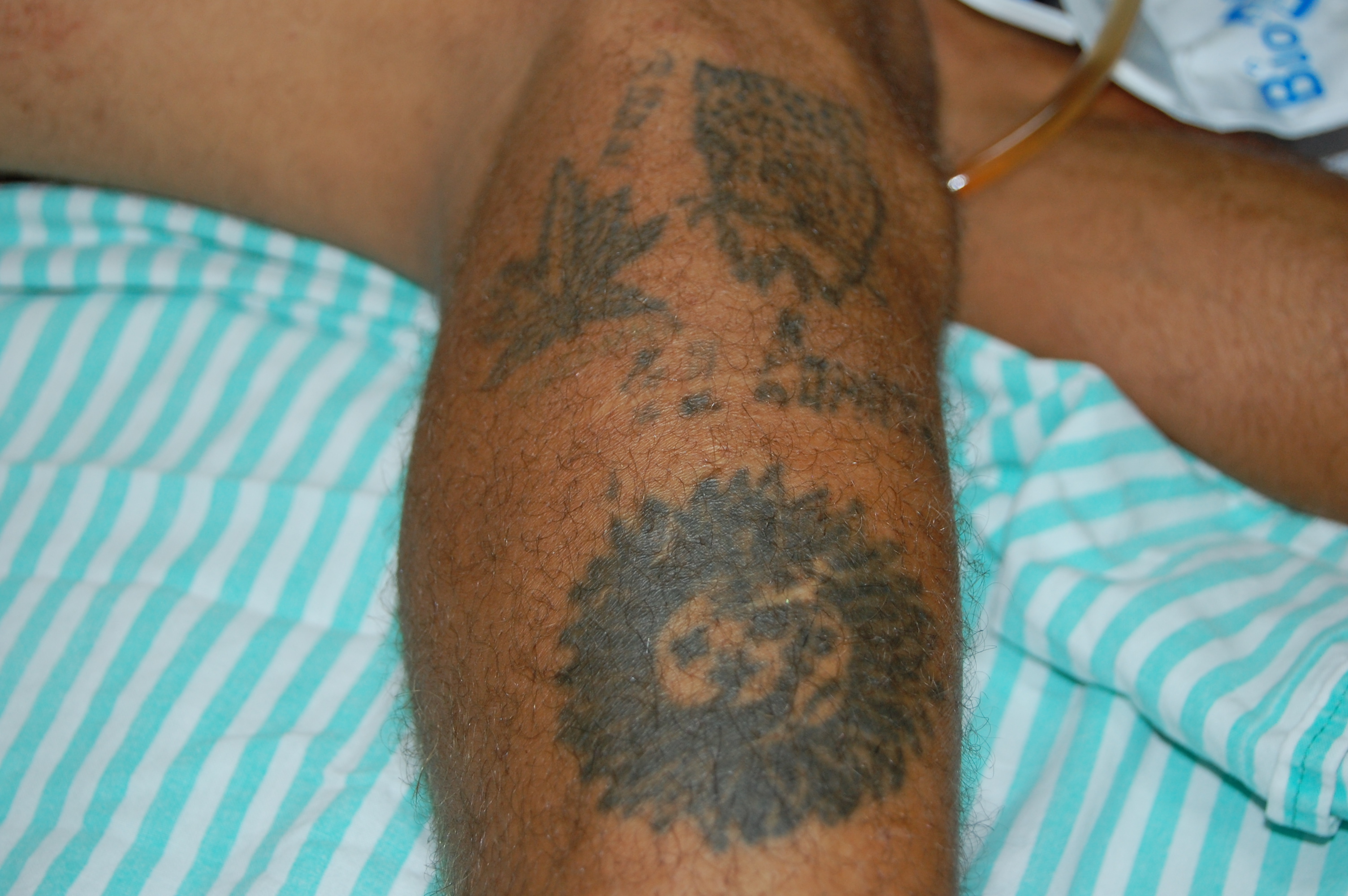 Tatuagens podem ajudar na identificação
