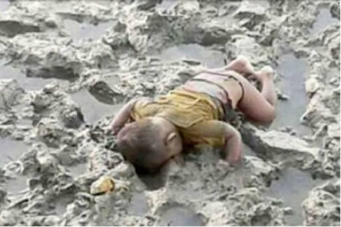 Bebê Mohammed Shohaynet, de 6 meses