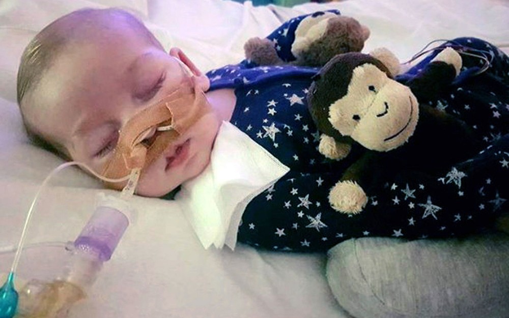 A síndrome rara de Charlie Gard impede que ele se mova