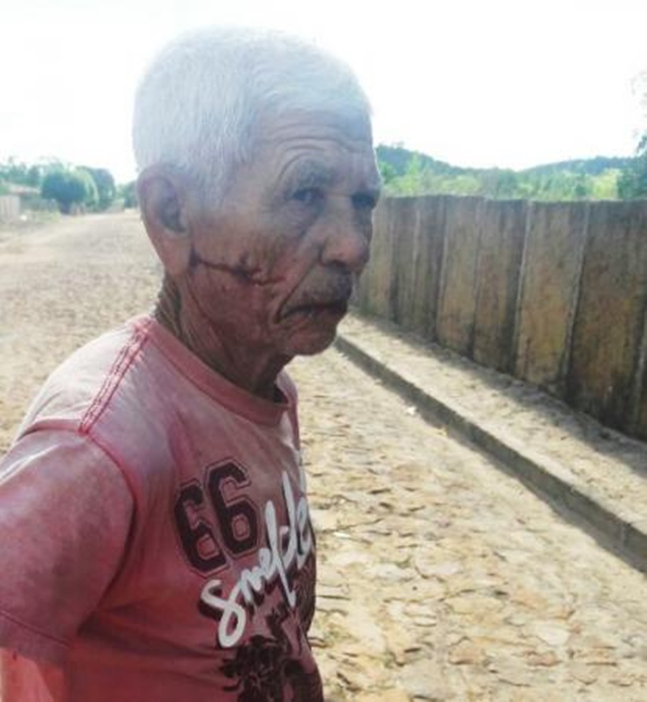 Idoso foi agredido dentro de casa