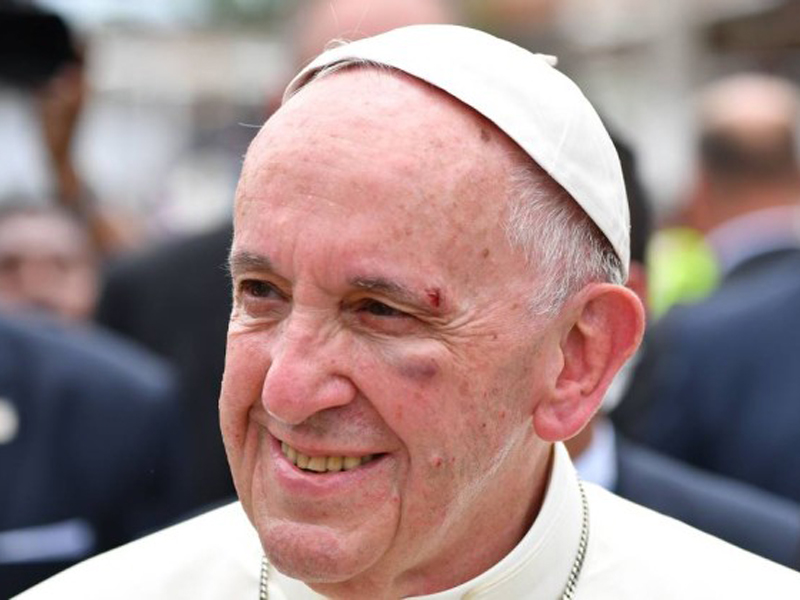 Papa se machuca em visita à Colômbia