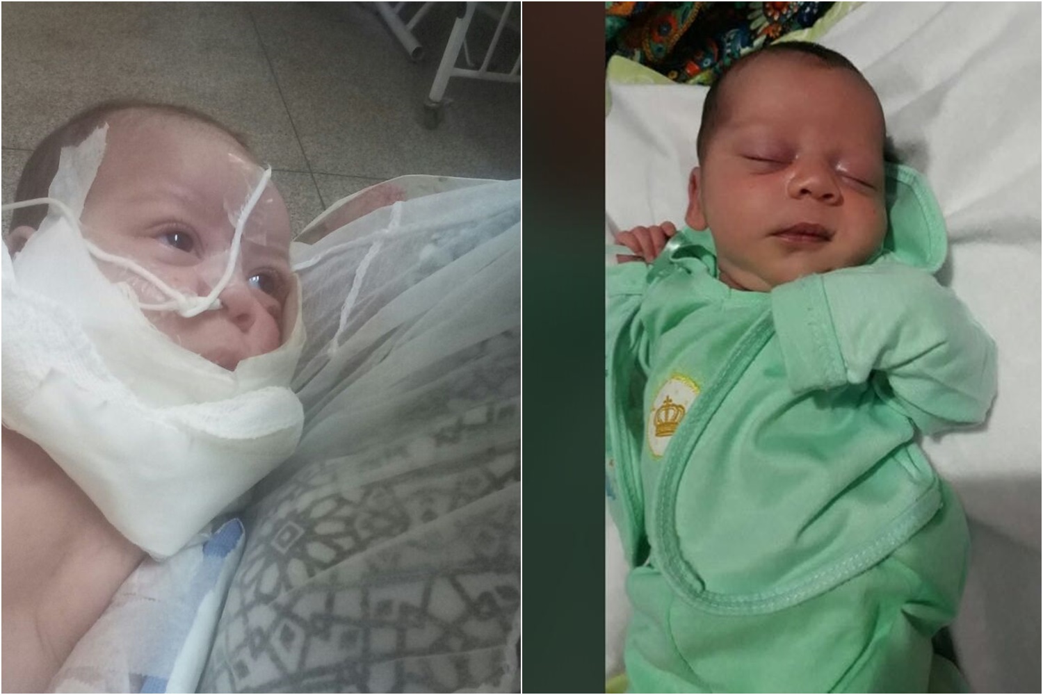 Bebê agredido pelo pai