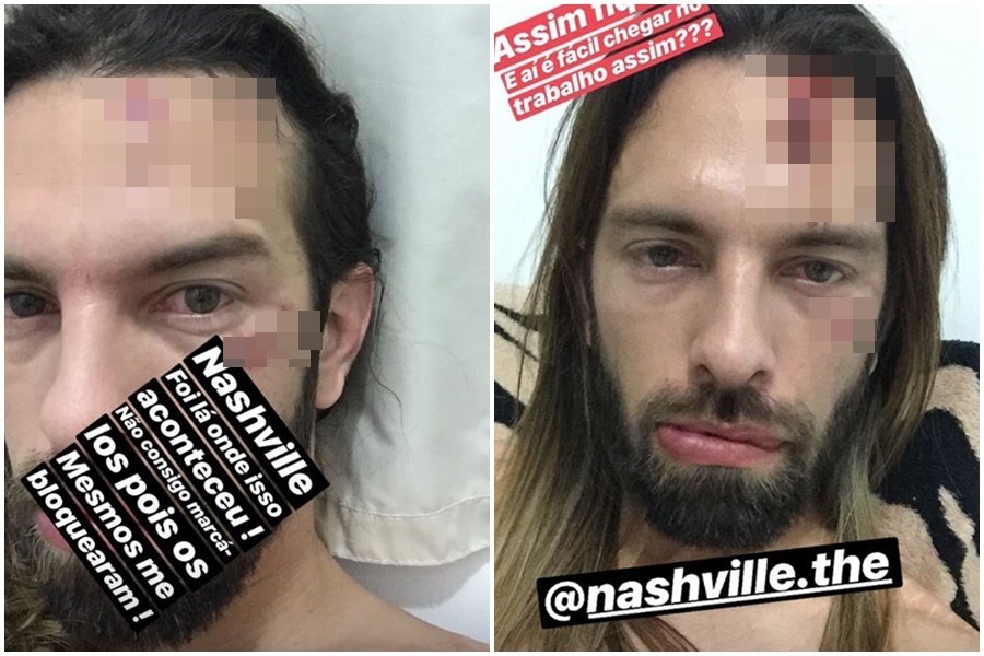 Felipe falou sobre o caso em sua rede social