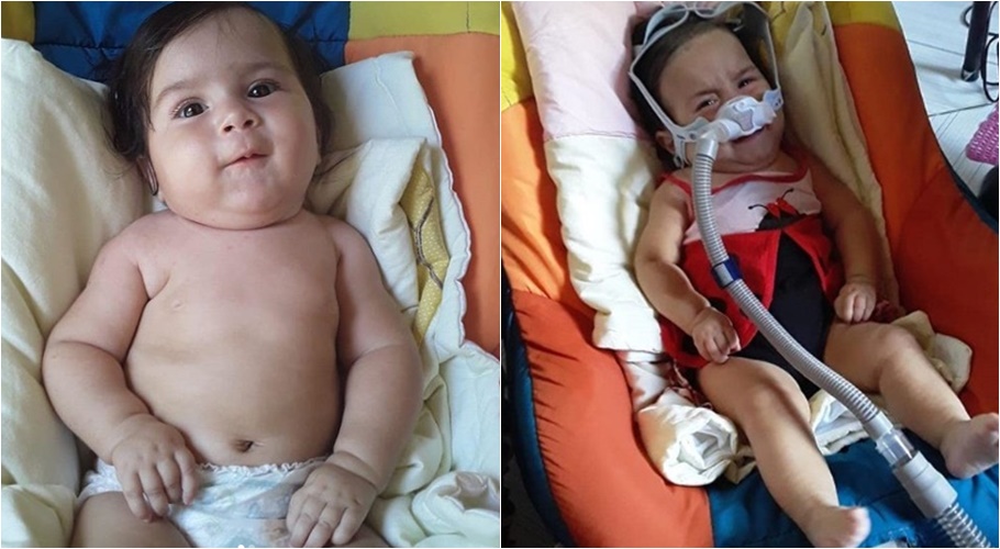 Kemily foi diagnosticada com AME Tipo 1