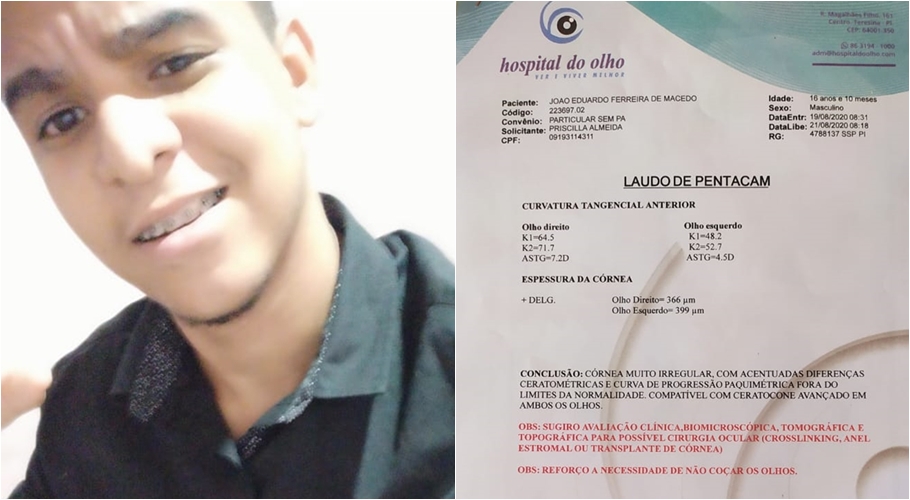 Adolescente está com a visão comprometida